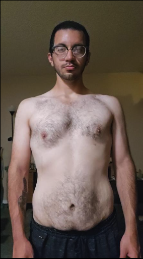 Gabe after